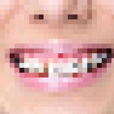 braces
